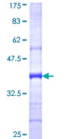ab164013 on a 12.5% SDS-PAGE stained with Coomassie Blue.
