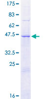 ab164148 on a 12.5% SDS-PAGE stained with Coomassie Blue.