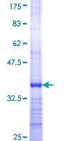 ab164149 on a 12.5% SDS-PAGE stained with Coomassie Blue.