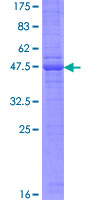 ab160723 on a 12.5% SDS-PAGE stained with Coomassie Blue.