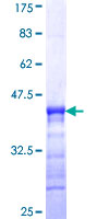 ab164758 on a 12.5% SDS-PAGE stained with Coomassie Blue.