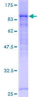 ab165838 on a 12.5% SDS-PAGE stained with Coomassie Blue.