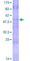 ab160192 on a 12.5% SDS-PAGE stained with Coomassie Blue.