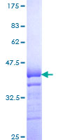 ab160191 on a 12.5% SDS-PAGE stained with Coomassie Blue.