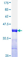 ab160177 on a 12.5% SDS-PAGE stained with Coomassie Blue.