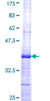 ab165585 on a 12.5% SDS-PAGE stained with Coomassie Blue.
