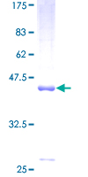 ab161382 on a 12.5% SDS-PAGE stained with Coomassie Blue.