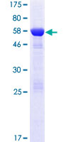 ab165201 on a 12.5% SDS-PAGE stained with Coomassie Blue.