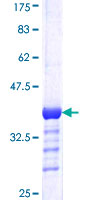 ab158269 on a 12.5% SDS-PAGE stained with Coomassie Blue.