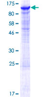 ab161583 on a 12.5% SDS-PAGE stained with Coomassie Blue.