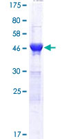 ab164562 on a 12.5% SDS-PAGE stained with Coomassie Blue.