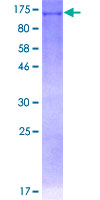 ab158272 on a 12.5% SDS-PAGE stained with Coomassie Blue.