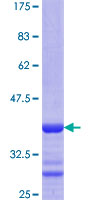 ab153094 on a 12.5% SDS-PAGE stained with Coomassie Blue.