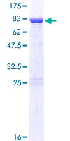 ab163058 on a 12.5% SDS-PAGE stained with Coomassie Blue.