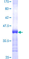 ab161386 on a 12.5% SDS-PAGE stained with Coomassie Blue.