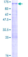 ab152960 on a 12.5% SDS-PAGE stained with Coomassie Blue.