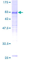 ab162227 on a 12.5% SDS-PAGE stained with Coomassie Blue.