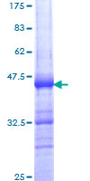 ab161992 on a 12.5% SDS-PAGE stained with Coomassie Blue.