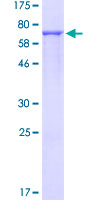 ab160882 on a 12.5% SDS-PAGE stained with Coomassie Blue.