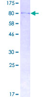 ab165799 on a 12.5% SDS-PAGE stained with Coomassie Blue.