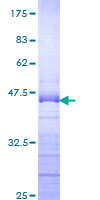 ab163967 on a 12.5% SDS-PAGE stained with Coomassie Blue.