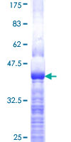 ab162803 on a 12.5% SDS-PAGE stained with Coomassie Blue.