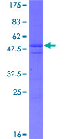ab163138 on a 12.5% SDS-PAGE stained with Coomassie Blue.