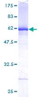 ab153323 on a 12.5% SDS-PAGE stained with Coomassie Blue.