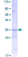 ab166006 on a 12.5% SDS-PAGE stained with Coomassie Blue.