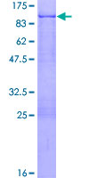 ab161032 on a 12.5% SDS-PAGE stained with Coomassie Blue.