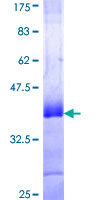 ab161033 on a 12.5% SDS-PAGE stained with Coomassie Blue.