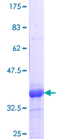 ab161034 on a 12.5% SDS-PAGE stained with Coomassie Blue.