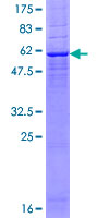 ab160100 on a 12.5% SDS-PAGE stained with Coomassie Blue.