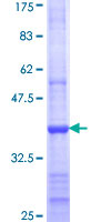 ab160101 on a 12.5% SDS-PAGE stained with Coomassie Blue.
