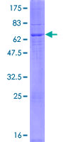 ab165196 on a 12.5% SDS-PAGE stained with Coomassie Blue.