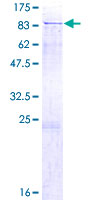 ab158326 on a 12.5% SDS-PAGE stained with Coomassie Blue.