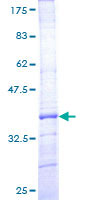 ab158327 on a 12.5% SDS-PAGE stained with Coomassie Blue.
