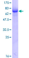 ab158367 on a 12.5% SDS-PAGE stained with Coomassie Blue.
