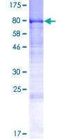 ab153463 on a 12.5% SDS-PAGE stained with Coomassie Blue.