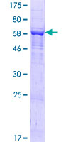 ab165760 on a 12.5% SDS-PAGE stained with Coomassie Blue.