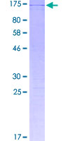 ab163766 on a 12.5% SDS-PAGE stained with Coomassie Blue.
