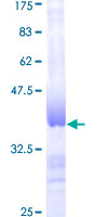 ab158281 on a 12.5% SDS-PAGE stained with Coomassie Blue.