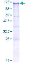 ab158317 on a 12.5% SDS-PAGE stained with Coomassie Blue.