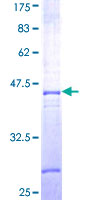ab158318 on a 12.5% SDS-PAGE stained with Coomassie Blue.