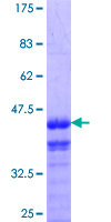 ab158319 on a 12.5% SDS-PAGE stained with Coomassie Blue.