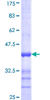ab158320 on a 12.5% SDS-PAGE stained with Coomassie Blue.