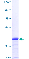 ab161606 on a 12.5% SDS-PAGE stained with Coomassie Blue.