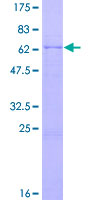 ab158274 on a 12.5% SDS-PAGE stained with Coomassie Blue.