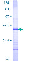 ab158275 on a 12.5% SDS-PAGE stained with Coomassie Blue.
