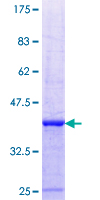 ab158278 on a 12.5% SDS-PAGE stained with Coomassie Blue.